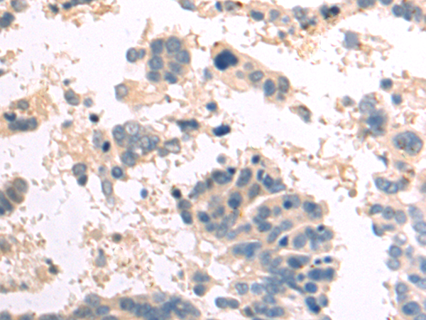 Rabbit Polyclonal Antibody to CHIA