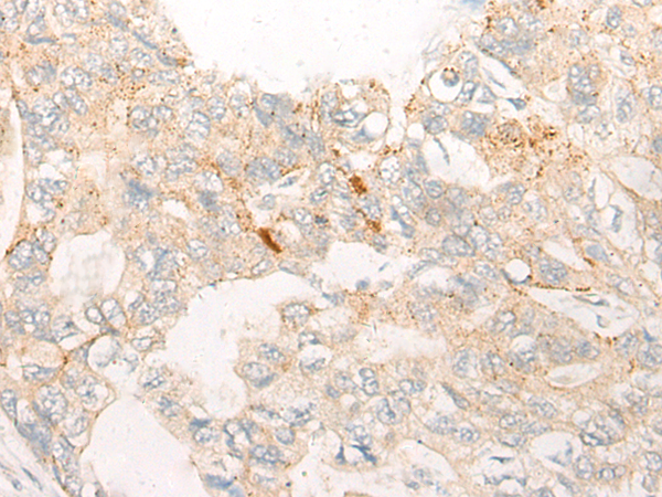 Rabbit Polyclonal Antibody to CHMP2B