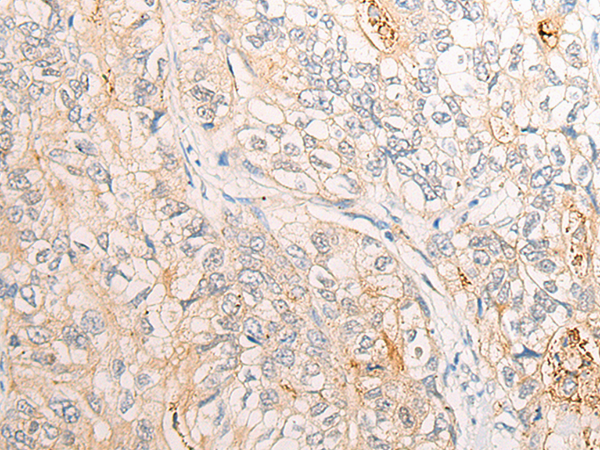 Rabbit Polyclonal Antibody to CHMP5
