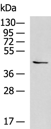 Rabbit Polyclonal Antibody to CHST10