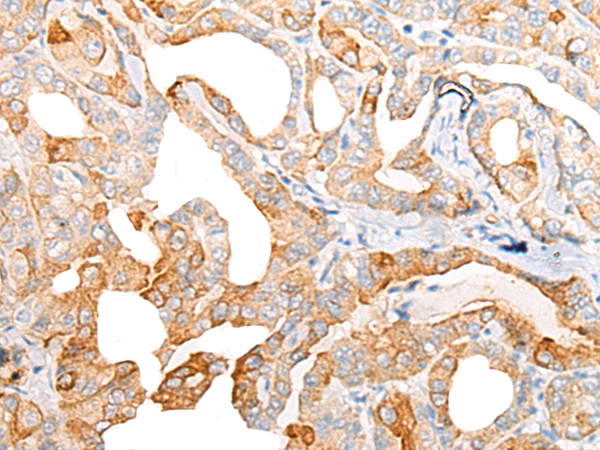Rabbit Polyclonal Antibody to CIAO1