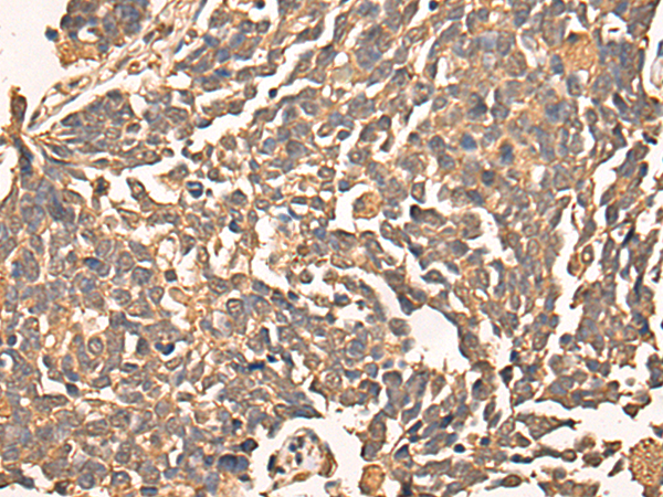 Rabbit Polyclonal Antibody to CINP