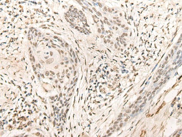 Rabbit Polyclonal Antibody to CIRBP
