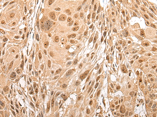 Rabbit Polyclonal Antibody to UTP4