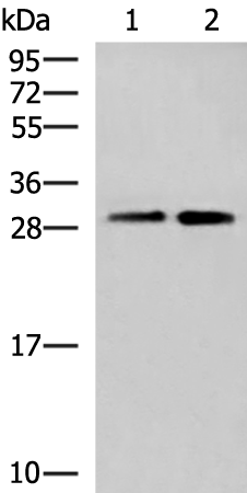 Rabbit Polyclonal Antibody to TBCB