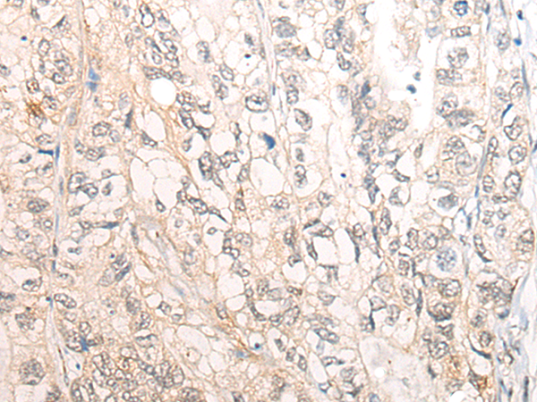 Rabbit Polyclonal Antibody to CSNK2A2