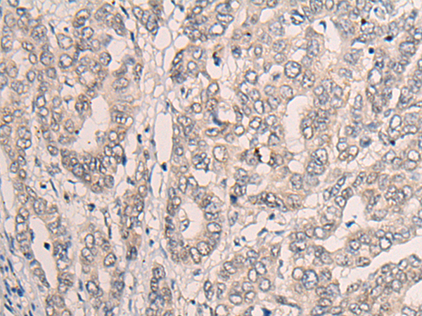 Rabbit Polyclonal Antibody to CLASP1
