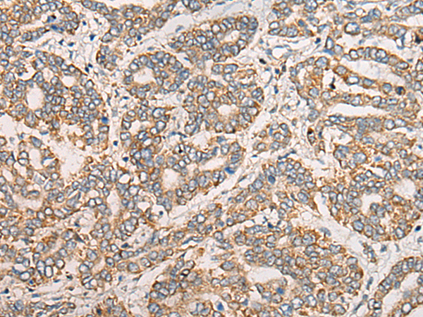 Rabbit Polyclonal Antibody to CLASP2