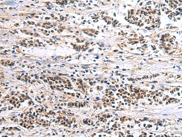 Rabbit Polyclonal Antibody to CLCN7