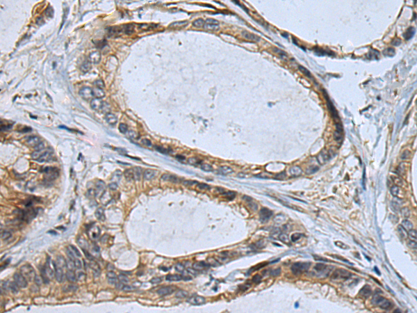Rabbit Polyclonal Antibody to CLIC2