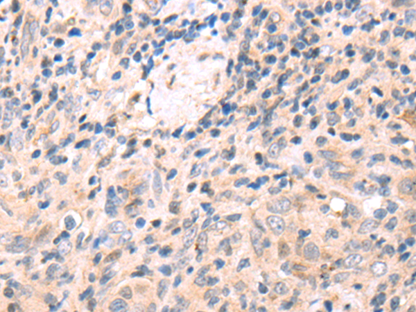 Rabbit Polyclonal Antibody to CLIC5