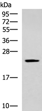 Rabbit Polyclonal Antibody to CMPK1