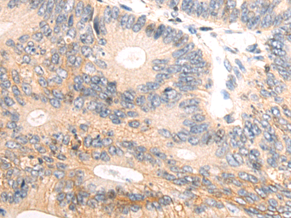 Rabbit Polyclonal Antibody to CNBP