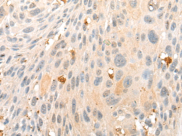 Rabbit Polyclonal Antibody to CNDP2