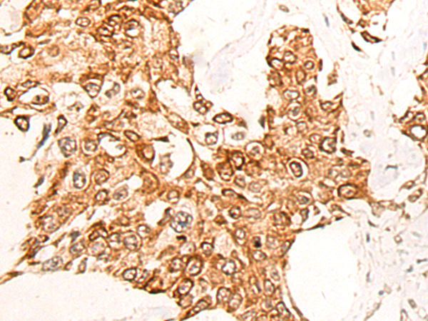 Rabbit Polyclonal Antibody to CNOT10