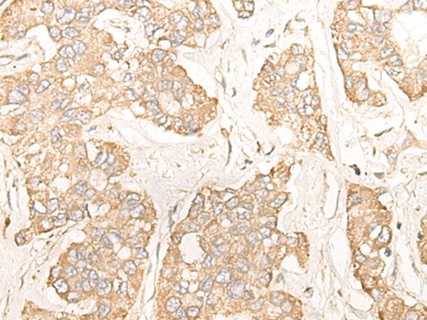 Rabbit Polyclonal Antibody to CNOT2