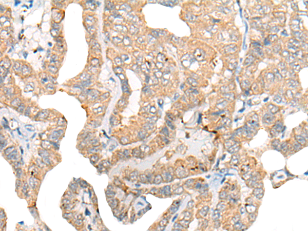Rabbit Polyclonal Antibody to CNTN4