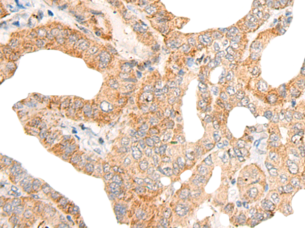 Rabbit Polyclonal Antibody to CALCOCO1