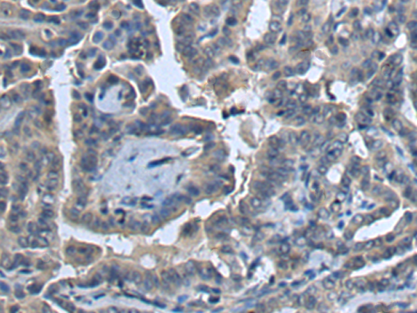 Rabbit Polyclonal Antibody to COG4