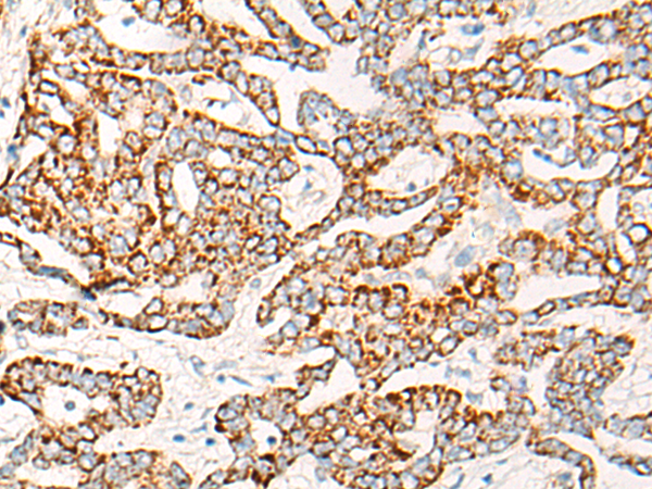 Rabbit Polyclonal Antibody to COG2