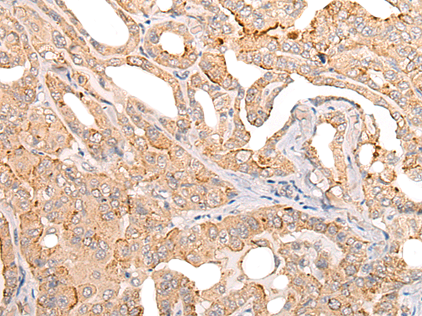Rabbit Polyclonal Antibody to COL11A1