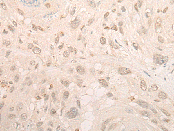 Rabbit Polyclonal Antibody to COPS6