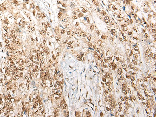 Rabbit Polyclonal Antibody to COPS7A