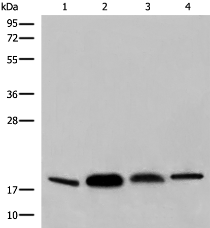 Rabbit Polyclonal Antibody to COPZ1