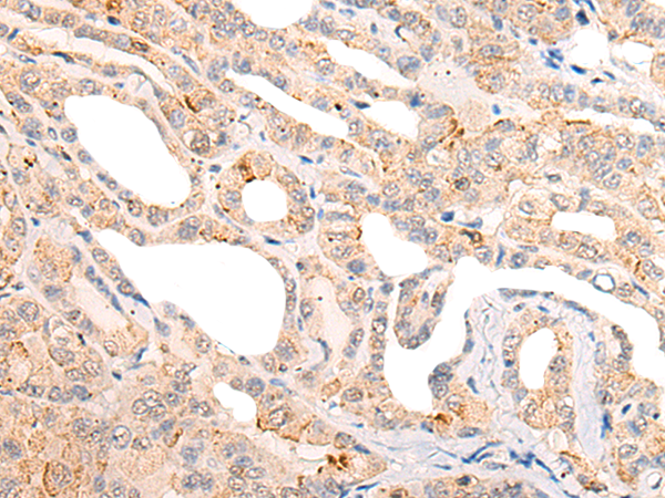 Rabbit Polyclonal Antibody to CORO6