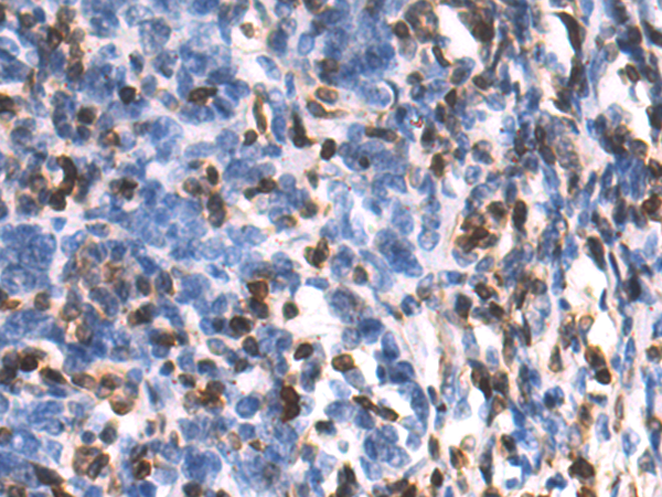 Rabbit Polyclonal Antibody to WWTR1