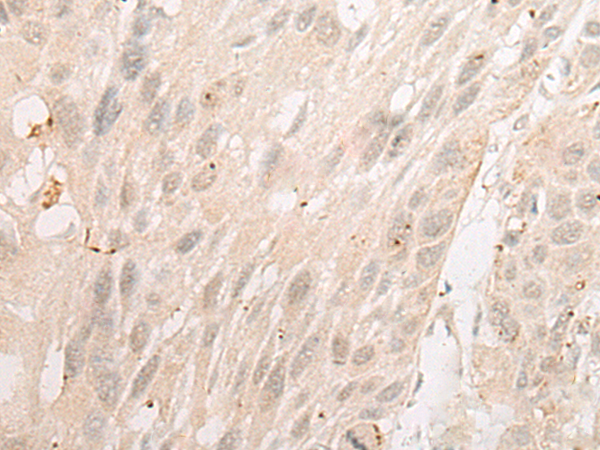 Rabbit Polyclonal Antibody to TFCP2