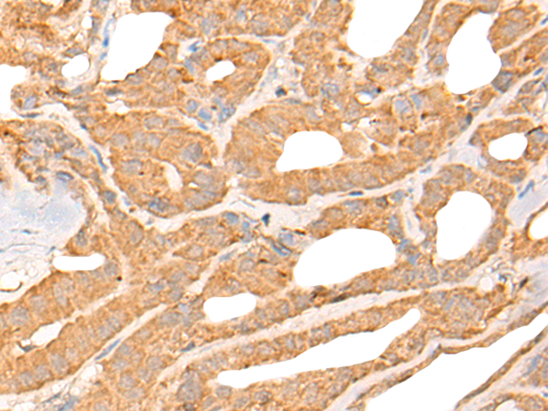 Rabbit Polyclonal Antibody to CPEB4