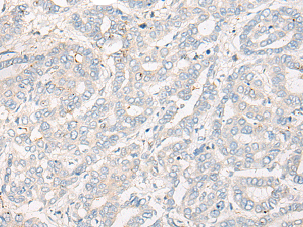 Rabbit Polyclonal Antibody to CPNE3