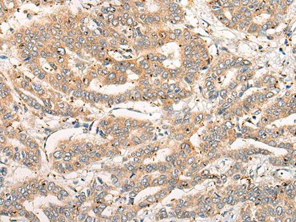 Rabbit Polyclonal Antibody to CPNE4