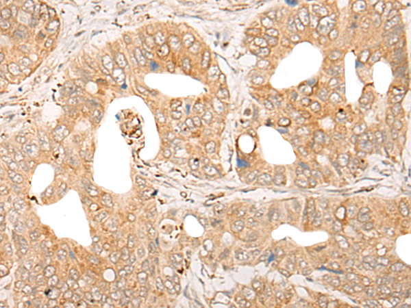 Rabbit Polyclonal Antibody to CPNE6
