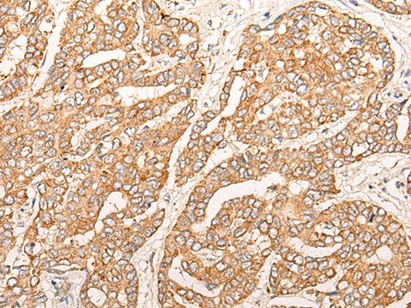 Rabbit Polyclonal Antibody to CPNE7