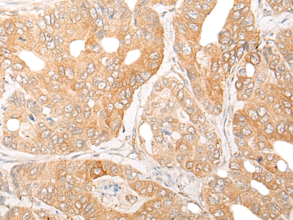 Rabbit Polyclonal Antibody to CPNE8