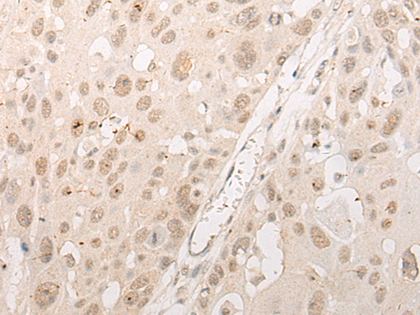 Rabbit Polyclonal Antibody to CPSF1