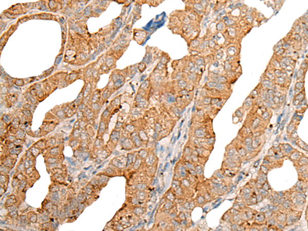 Rabbit Polyclonal Antibody to CPT1B
