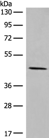 Rabbit Polyclonal Antibody to CPVL