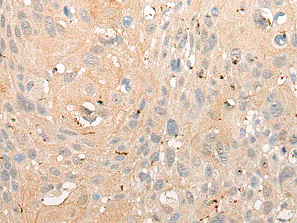 Rabbit Polyclonal Antibody to CRAT