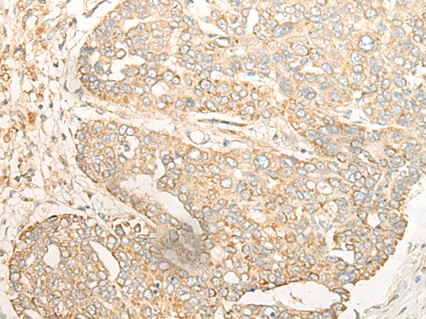 Rabbit Polyclonal Antibody to CRB3