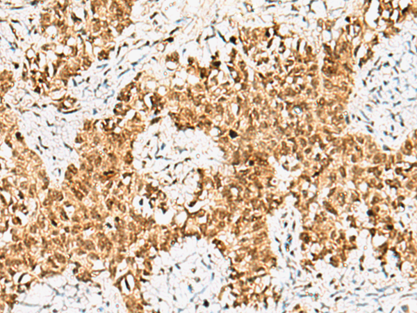 Rabbit Polyclonal Antibody to CRCP