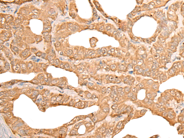 Rabbit Polyclonal Antibody to CUTA