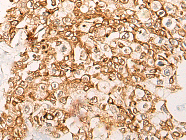 Rabbit Polyclonal Antibody to CWF19L1