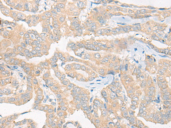Rabbit Polyclonal Antibody to CYFIP1