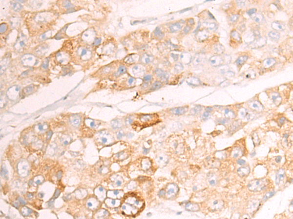 Rabbit Polyclonal Antibody to CYP20A1
