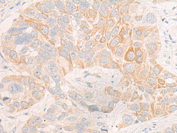 Rabbit Polyclonal Antibody to CYP4F12
