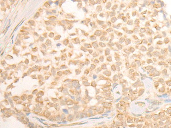 Rabbit Polyclonal Antibody to CYP4X1