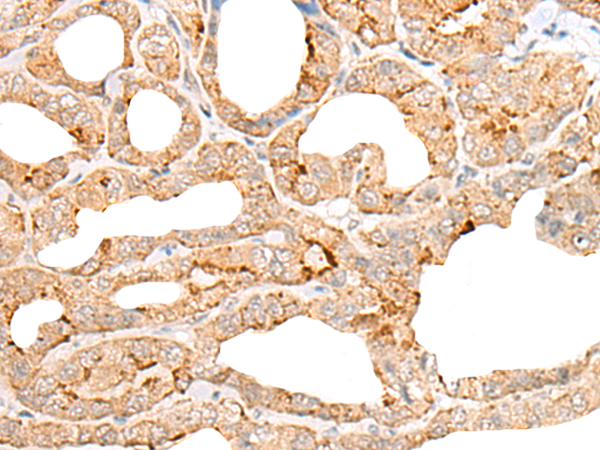 Rabbit Polyclonal Antibody to CST1
